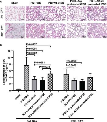 Nitric oxide-mediated the therapeutic properties of induced pluripotent stem cell for paraquat-induced acute lung injury